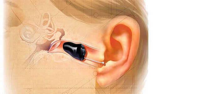 Глубококанальный слуховой аппарат