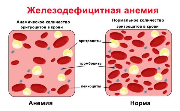 Показатель гемоглобина у пожилых