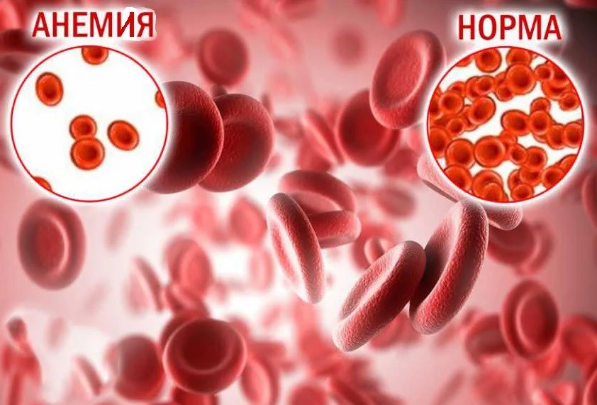 Норма гемоглобина в крови у пожилых