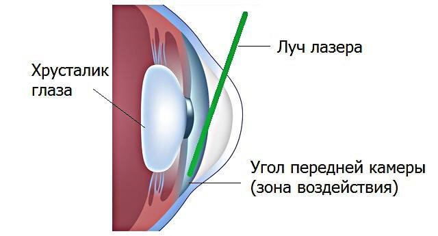 Глазные капли при глаукоме